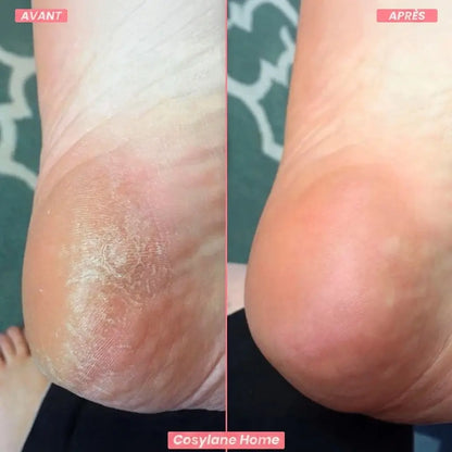 ✨ CosyGlow™ – Kit Beauté Pieds