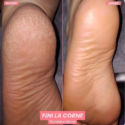 ✨ CosyGlow™ – Kit Beauté Pieds
